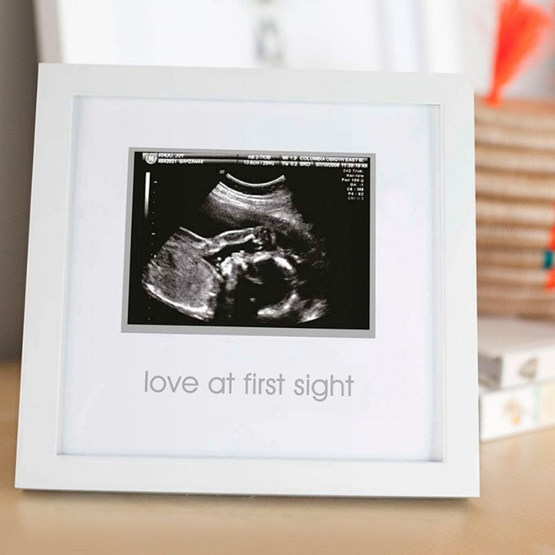 Sonogram Frame