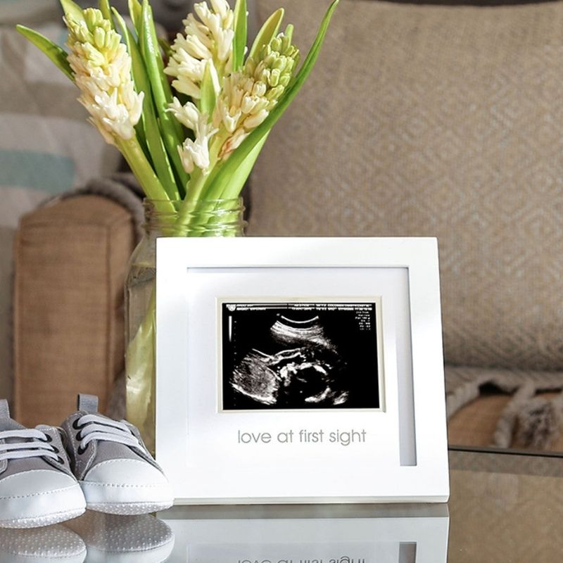 Sonogram Frame